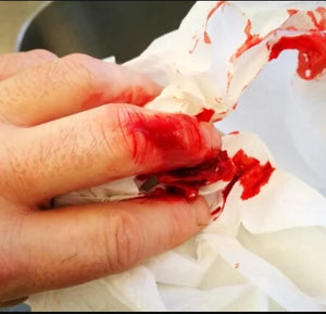 Bleeding